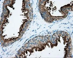 IHC-P analysis of prostate tissue using GTX83825 PKA R2 antibody [4A3]. Antigen retrieval : Heat-induced epitope retrieval by 10mM citrate buffer, pH6.0, 100oC for 10min. Dilution : 1:50