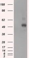 WB analysis of HEK293T cells transfected with PKA R2 plasmid (Right) or empty vector (Left) for 48 hrs using GTX83825 PKA R2 antibody [4A3]. Loading : 5 ug per lane