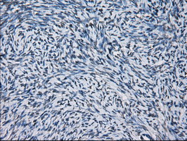 IHC-P analysis of human endometrium tissue using GTX83828 PRX IV antibody [9A3]. Antigen retrieval : Heat-induced epitope retrieval by 10mM citrate buffer,pH6.0,100? for 10min.