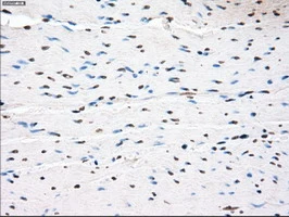 IHC-P analysis of human colon tissue using GTX83836 PPP5C antibody [3G1]. Antigen retrieval : Heat-induced epitope retrieval by 10mM citrate buffer, pH6.0, 100oC for 10min.