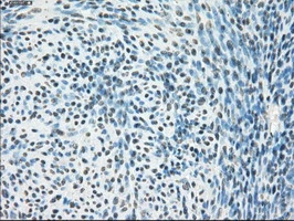 IHC-P analysis of human endometrium tissue using GTX83836 PPP5C antibody [3G1]. Antigen retrieval : Heat-induced epitope retrieval by 10mM citrate buffer, pH6.0, 100oC for 10min.