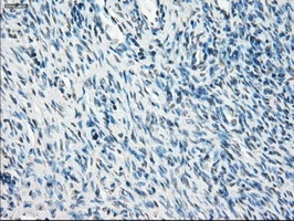 IHC-P analysis of human ovary tissue using GTX83836 PPP5C antibody [3G1]. Antigen retrieval : Heat-induced epitope retrieval by 10mM citrate buffer, pH6.0, 100oC for 10min.