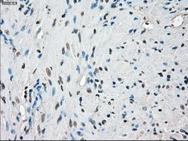 IHC-P analysis of human prostate tissue using GTX83836 PPP5C antibody [3G1]. Antigen retrieval : Heat-induced epitope retrieval by 10mM citrate buffer, pH6.0, 100oC for 10min.