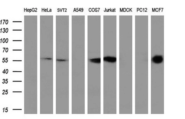 WB analysis of various cell lines using GTX83836 PPP5C antibody [3G1]. Loading : 35 ug per lane Dilution : 1:200