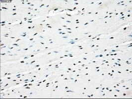 IHC-P analysis of human colon tissue using GTX83838 PPP5C antibody [6F1]. Antigen retrieval : Heat-induced epitope retrieval by 10mM citrate buffer, pH6.0, 100oC for 10min.