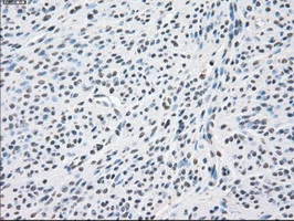 IHC-P analysis of human endometrium tissue using GTX83838 PPP5C antibody [6F1]. Antigen retrieval : Heat-induced epitope retrieval by 10mM citrate buffer, pH6.0, 100oC for 10min.