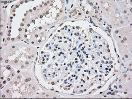 IHC-P analysis of human kidney tissue using GTX83838 PPP5C antibody [6F1]. Antigen retrieval : Heat-induced epitope retrieval by 10mM citrate buffer, pH6.0, 100oC for 10min.