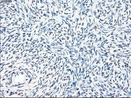 IHC-P analysis of human ovary tissue using GTX83838 PPP5C antibody [6F1]. Antigen retrieval : Heat-induced epitope retrieval by 10mM citrate buffer, pH6.0, 100oC for 10min.
