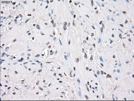 IHC-P analysis of human prostate tissue using GTX83838 PPP5C antibody [6F1]. Antigen retrieval : Heat-induced epitope retrieval by 10mM citrate buffer, pH6.0, 100oC for 10min.
