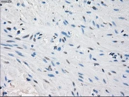 IHC-P analysis of human colon tissue using GTX83840 PPP5C antibody [5G5]. Antigen retrieval : Heat-induced epitope retrieval by 10mM citrate buffer, pH6.0, 100oC for 10min.