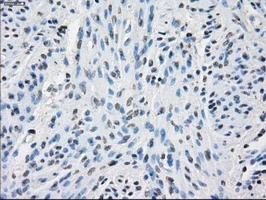 IHC-P analysis of human endometrium tissue using GTX83840 PPP5C antibody [5G5]. Antigen retrieval : Heat-induced epitope retrieval by 10mM citrate buffer, pH6.0, 100oC for 10min.