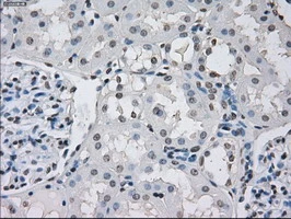 IHC-P analysis of human kidney tissue using GTX83840 PPP5C antibody [5G5]. Antigen retrieval : Heat-induced epitope retrieval by 10mM citrate buffer, pH6.0, 100oC for 10min.