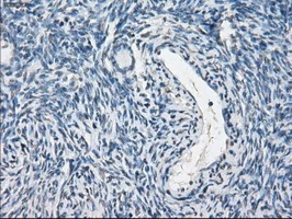 IHC-P analysis of human ovary tissue using GTX83840 PPP5C antibody [5G5]. Antigen retrieval : Heat-induced epitope retrieval by 10mM citrate buffer, pH6.0, 100oC for 10min.