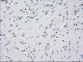 IHC-P analysis of human prostate tissue using GTX83840 PPP5C antibody [5G5]. Antigen retrieval : Heat-induced epitope retrieval by 10mM citrate buffer, pH6.0, 100oC for 10min.
