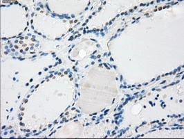 IHC-P analysis of human thyroid tissue using GTX83840 PPP5C antibody [5G5]. Antigen retrieval : Heat-induced epitope retrieval by 10mM citrate buffer, pH6.0, 100oC for 10min.