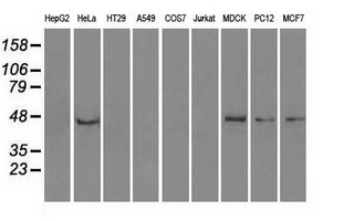 WB analysis of various cell lines using GTX83843 PPP1R7 antibody [4F9]. Loading : 35 ug per lane