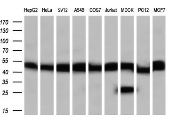 WB analysis of HEK293T cells transfected with PPME1 plasmid (Right) or empty vector (Left) for 48 hrs using GTX83847 PPME1 antibody [7F12]. Loading : 5 ug per lane