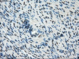 IHC-P analysis of human ovary tissue using GTX83854 POR antibody [6C4]. Antigen retrieval : Heat-induced epitope retrieval by 10mM citrate buffer, pH6.0, 100oC for 10min.