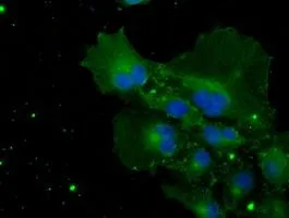 ICC/IF analysis of COS7 cells transiently transfected with POR plasmid using GTX83854 POR antibody [6C4].