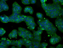 ICC/IF analysis of HeLa cells using GTX83854 POR antibody [6C4].