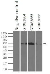 IP analysis of DDDDK tagged PLK1 overexpressed HEK293T lysate using GTX83864 PLK1 antibody [3F12].After extensive wash to remove any non-specific binding, the immuno-precipitated products were analyzed with rabbit anti-DDDDK polyclonal antibody. IP reaction : 2microg antibody / 500microl cell lysate