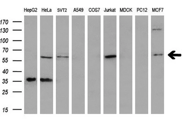 WB analysis of various cell lines using GTX83864 PLK1 antibody [3F12]. Loading : 35 ug per lane Dilution : 1:200