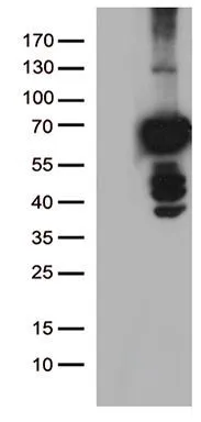 WB analysis of HEK293T cells transfected with PLK1 plasmid (Right) or empty vector (Left) for 48 hrs using GTX83864 PLK1 antibody [3F12]. Loading : 5 ug per lane Dilution : 1:500
