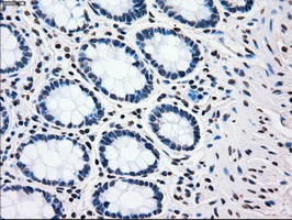 IHC-P analysis of human colon tissue using GTX83865 PLK1 antibody [1D4]. Antigen retrieval : Heat-induced epitope retrieval by 10mM citrate buffer, pH6.0, 100oC for 10min.