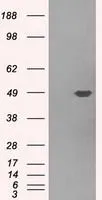 WB analysis of HEK293T cells transfected with Pleckstrin plasmid (Right) or empty vector (Left) for 48 hrs using GTX83873 Pleckstrin antibody [4F10]. Loading : 5 ug per lane