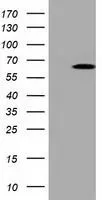 WB analysis of HEK293T cells transfected with Pyruvate Kinase (liver/RBC) plasmid (Right) or empty vector (Left) for 48 hrs using GTX83885 Pyruvate Kinase (liver/RBC) antibody [1A5]. Loading : 5 ug per lane