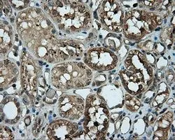 IHC-P analysis of kidney tissue using GTX83886 PIM2 antibody [10A12]. Antigen retrieval : Heat-induced epitope retrieval by 10mM citrate buffer, pH6.0, 100oC for 10min. Dilution : 1:50