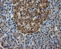 IHC-P analysis of pancreas tissue using GTX83886 PIM2 antibody [10A12]. Antigen retrieval : Heat-induced epitope retrieval by 10mM citrate buffer, pH6.0, 100oC for 10min. Dilution : 1:50