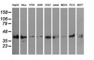 WB analysis of various cell lines using GTX83886 PIM2 antibody [10A12]. Loading : 35 ug per lane