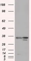 WB analysis of HEK293T cells transfected with PIM2 plasmid (Right) or empty vector (Left) for 48 hrs using GTX83886 PIM2 antibody [10A12]. Loading : 5 ug per lane