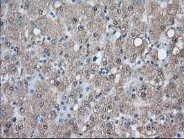 IHC-P analysis of human liver tissue using GTX83892 PIM2 antibody [9A5]. Antigen retrieval : Heat-induced epitope retrieval by 10mM citrate buffer, pH6.0, 100oC for 10min.