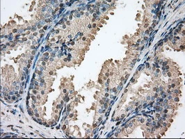 IHC-P analysis of human prostate tissue using GTX83892 PIM2 antibody [9A5]. Antigen retrieval : Heat-induced epitope retrieval by 10mM citrate buffer, pH6.0, 100oC for 10min.