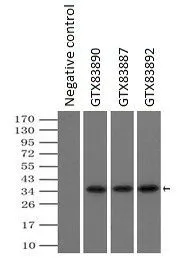 IP analysis of DDDDK tagged PIM2 overexpressed HEK293T lysate using GTX83892 PIM2 antibody [9A5].After extensive wash to remove any non-specific binding, the immuno-precipitated products were analyzed with rabbit anti-DDDDK polyclonal antibody. IP reaction : 2microg antibody / 500microl cell lysate