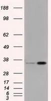 WB analysis of HEK293T cells transfected with PIM2 plasmid (Right) or empty vector (Left) for 48 hrs using GTX83892 PIM2 antibody [9A5]. Loading : 5 ug per lane