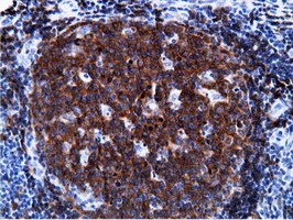 IHC-P analysis of human lymph node tissue using GTX83893 PIK3AP1 antibody [7A11]. Antigen retrieval : Heat-induced epitope retrieval by 10mM citrate buffer, pH6.0, 100oC for 10min.