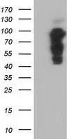 WB analysis of HEK293T cells transfected with PIK3AP1 plasmid (Right) or empty vector (Left) for 48 hrs using GTX83898 PIK3AP1 antibody [7G9]. Loading : 5 ug per lane