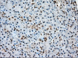 IHC-P analysis of human pancreas tissue using GTX83903 Profilin 1 antibody [1D5]. Antigen retrieval : Heat-induced epitope retrieval by 10mM citrate buffer, pH6.0, 100oC for 10min. Dilution : 1:50