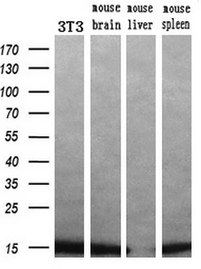 WB analysis of various samples using GTX83903 Profilin 1 antibody [1D5]. Loading : 10 ug per lane Dilution : 1:200
