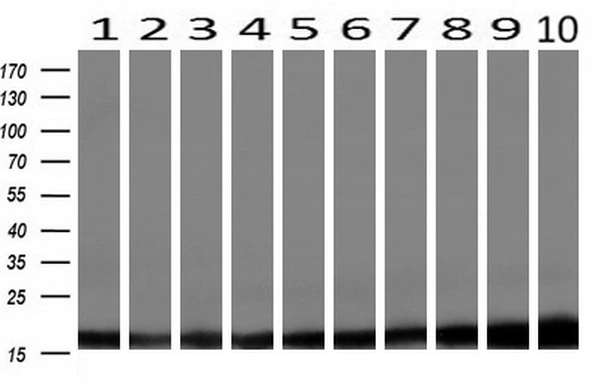 WB analysis of human tissues (Lane 1-Testis ; Lane 2-Omentum ; Lane 3-Uterus ; Lane 4-Breast ; Lane 5-Brain ; Lane 6-Liver ; Lane 7-Ovary ; Lane 8-Thyroid gland ; Lane 9-colon ; Lane 10-spleen) using GTX83903 Profilin 1 antibody [1D5]. Loading : 10 ug per lane Dilution : 1:200