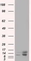 WB analysis of HEK293T cells transfected with Profilin 1 plasmid (Right) or empty vector (Left) for 48 hrs using GTX83903 Profilin 1 antibody [1D5]. Loading : 5 ug per lane