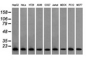 WB analysis of various cell lines using GTX83903 Profilin 1 antibody [1D5]. Loading : 35 ug per lane