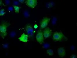 ICC/IF analysis of COS7 cells transiently transfected with Profilin 1 plasmid using GTX83903 Profilin 1 antibody [1D5].