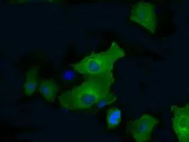 ICC/IF analysis of COS7 cells transiently transfected with PFKFB4 plasmid using GTX83904 PFKFB4 antibody [1C8].