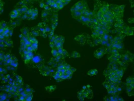 ICC/IF analysis of HepG2 cells using GTX83904 PFKFB4 antibody [1C8].