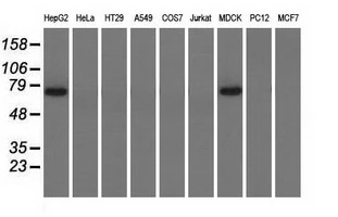 WB analysis of various cell lines using GTX83908 PEX5 antibody [1D3]. Loading : 35 ug per lane