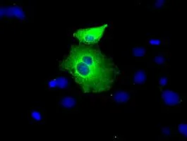 ICC/IF analysis of COS7 cells transiently transfected with PEX5 plasmid using GTX83908 PEX5 antibody [1D3].
